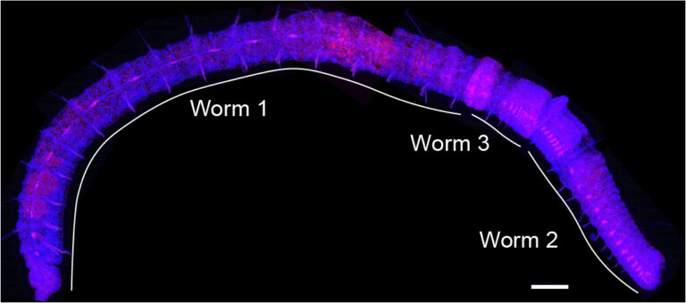 Unlocking the ‘chain of worms’